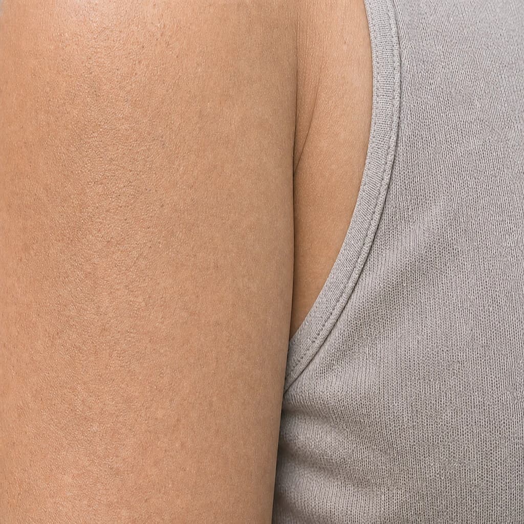 Ảnh khách hàng thực tế sau xử lý — Thâm do mặc đồng phục, mồ hôi