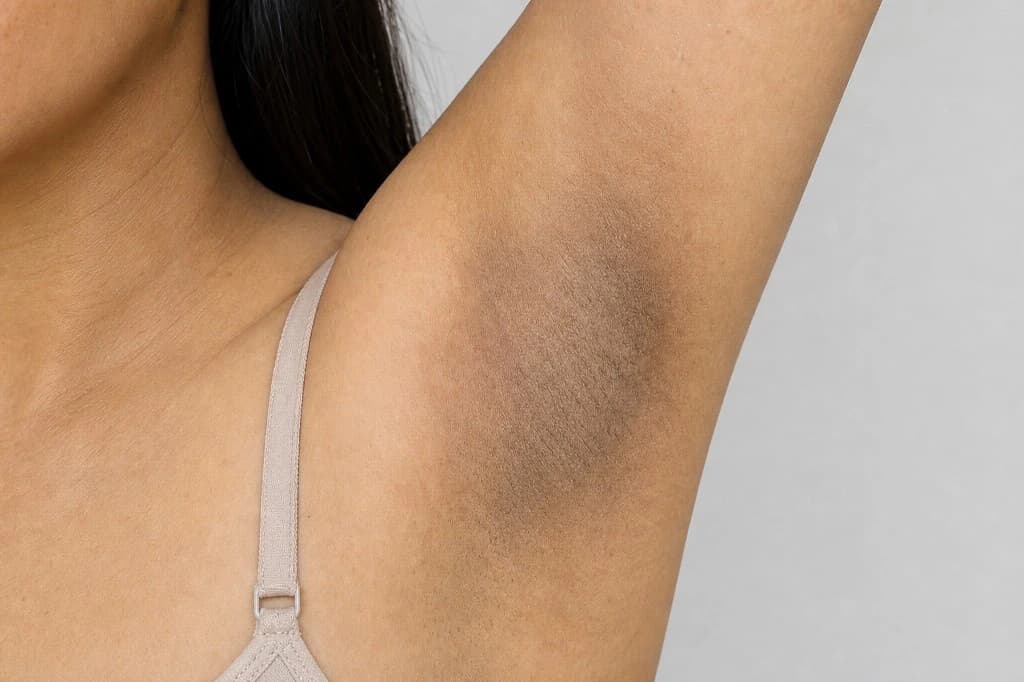 Ảnh khách hàng thực tế trước xử lý — Đã dùng nhiều kem nhưng chưa rõ hướng