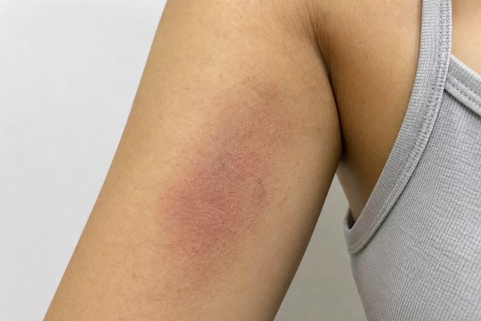 Ảnh khách hàng thực tế trước xử lý — Da dễ kích ứng, sợ làm mạnh