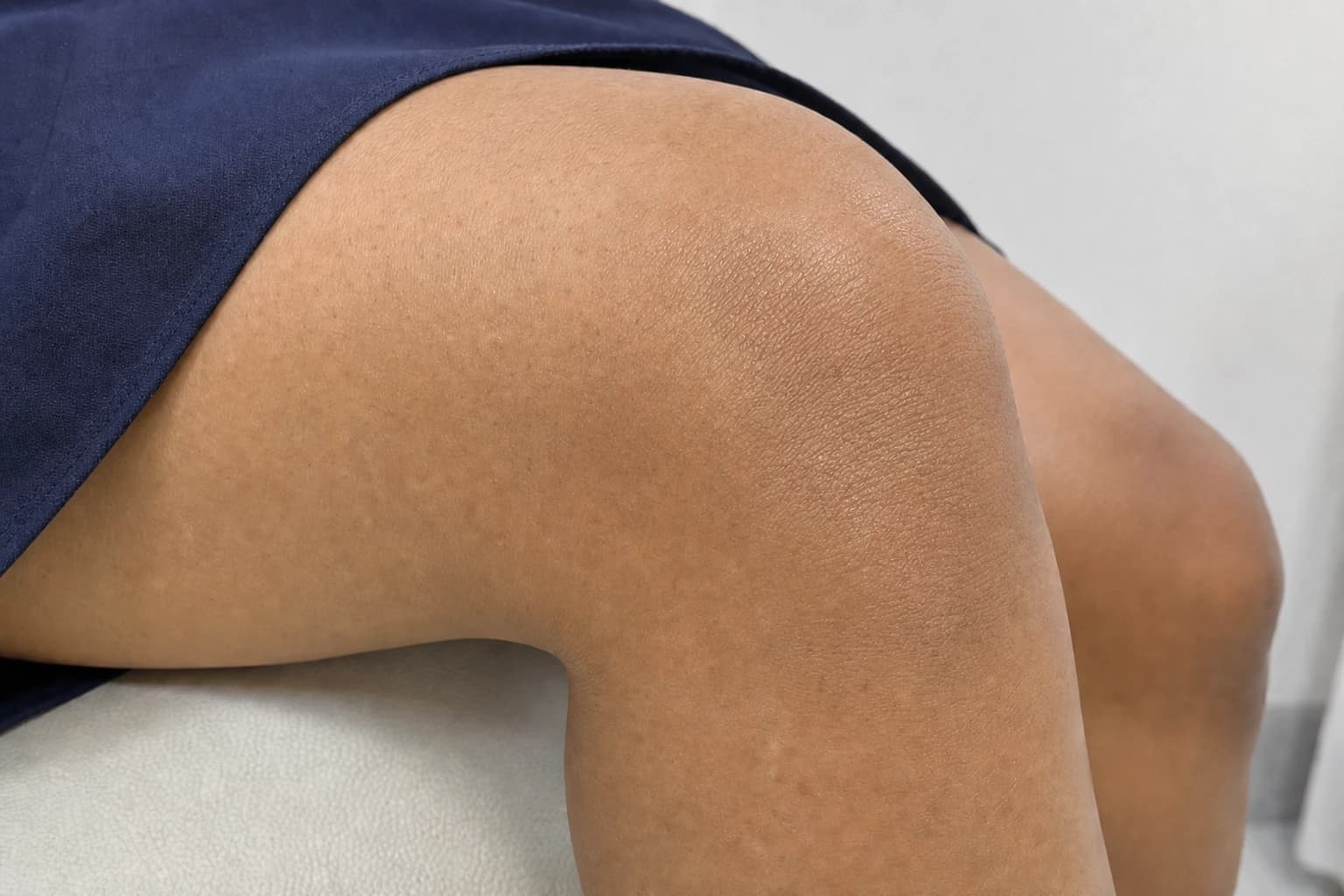 Ảnh khách hàng thực tế sau xử lý — Đầu gối thâm do quỳ, ma sát và khô da