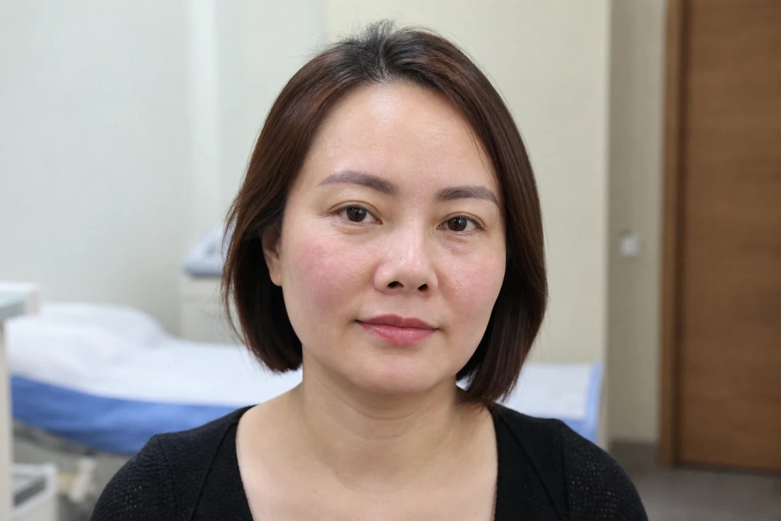 Da nhạy cảm, dễ kích ứng — tham chiếu trong tư vấn tại phòng khám Avo Medical.